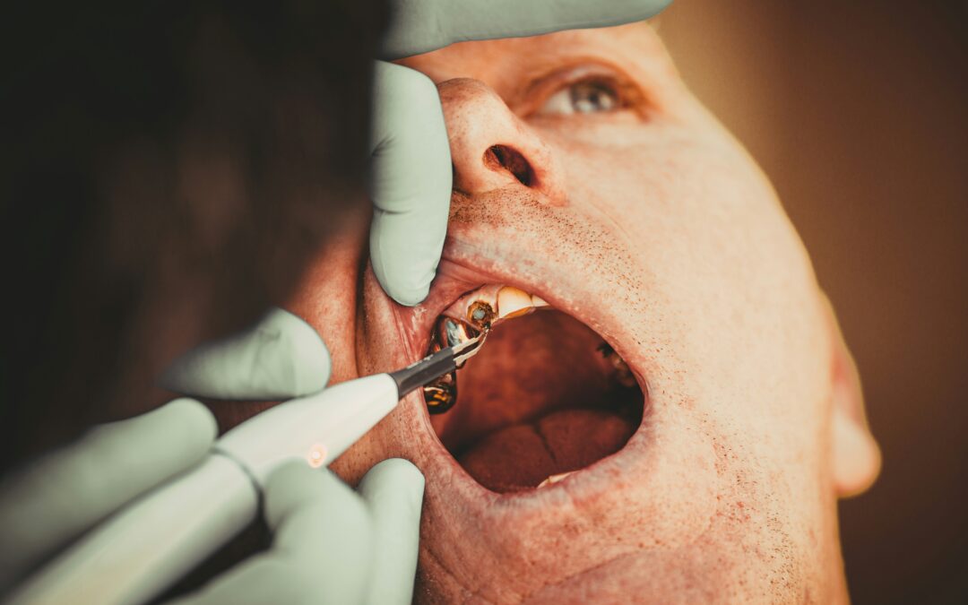 Dentist performing an oral surgery procedure at Scottsdale Family Dentistry